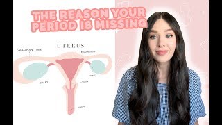 Alasan UTAMA Haid Hilang! (Menstruasi terlambat & menstruasi hilang)