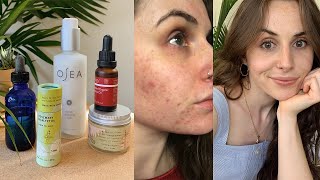 My Skin Care Routine & How I Cleared my Acne Without Fancy Products | minimalist & low waste