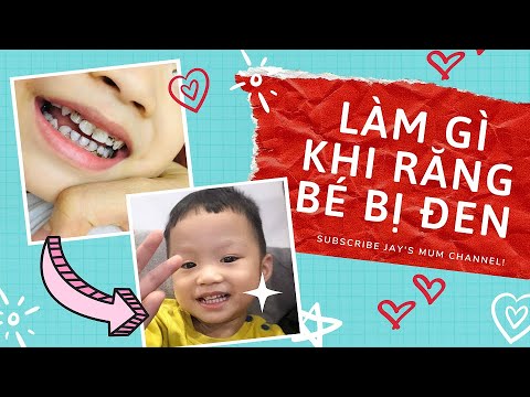 Video: Cách Làm Trắng Răng ở Trẻ Em