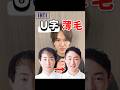 【U字 薄毛 髪型】カットでここまで変わる！全体のバランスと前髪の長さが重要です#薄毛札幌#AGA札幌#札幌美容室#薄毛男性専門美容室#INTI札幌#shorts