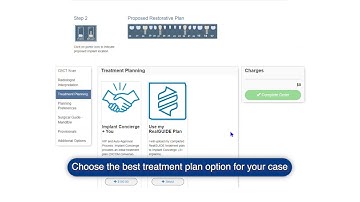 How To: Create a Case-Bone Borne Guide