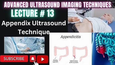 How to do Appendix Ultrasound lecturer 13 #ultrasound #technology #medical