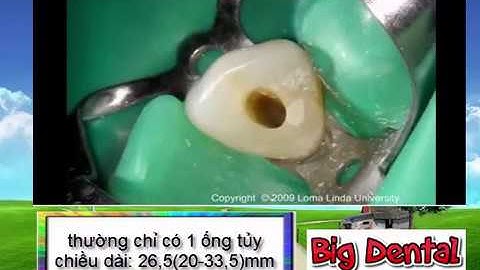 B.D: Mở tủy răng nanh hàm trên(Carlos Praco)