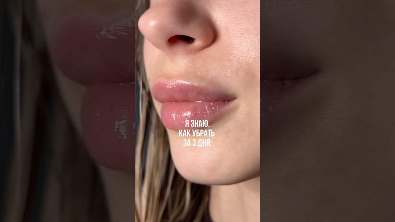 ориг. артикул: 