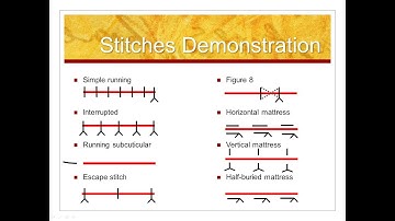 Types of Stitches: Just to Keep You in Stitches (Suturing Techniques & Tricks: Part 5)