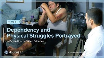 Loss of Independence and Full Case Value Revealed With Day-in-the-Life Videos