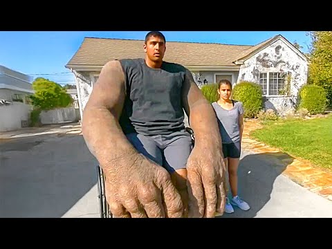أشخاص لديهم أعضاء جسدية ضخمة بشكل لا ي صدق لن تصدق عينيك