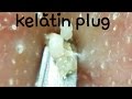 角栓ぬき&押し I pulled out & push keratinplug.