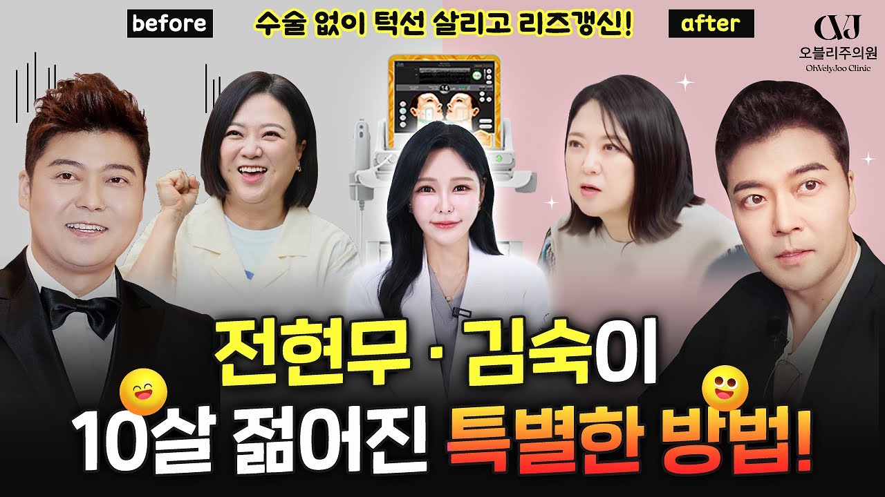 전현무와 김숙! 갑자기 슬림해진 얼굴! '이것'하고 젋어졌습니다. 그 비결은?