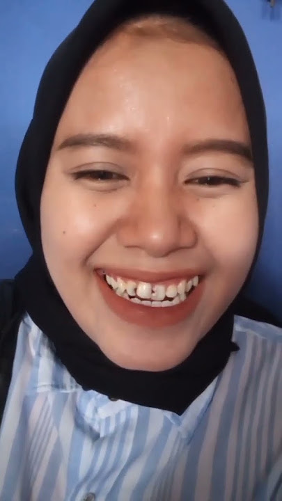 Tambal gigi depan biar makin PD | Kesehatan Gigi | Klinik | Dokter