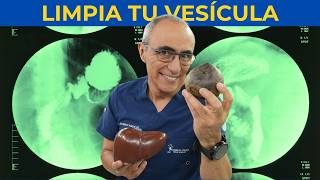 🌿 Estrategias Comprobadas para Mejorar Hígado Graso y Vesícula