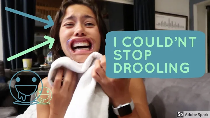 WATCH YA' MOUTH CHALLENGE