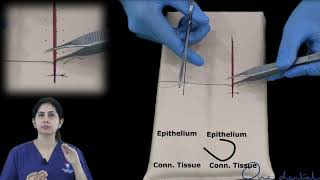 Figure of eight suture demonstration