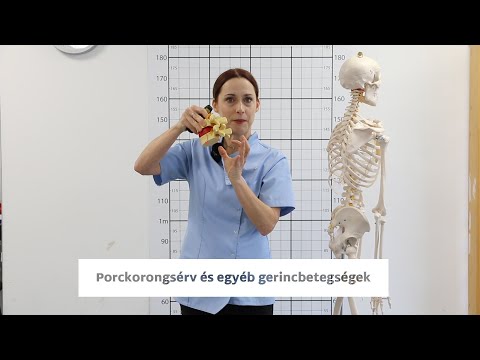 Videó: Előrehalad a degeneratív porckorongbetegség?