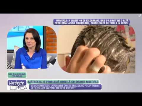 Video: Cum Să Scapi De Cosuri Pe Scalp