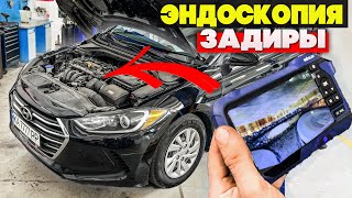 Hyundai Elantra 2.0 USA - ТВОЮ Ж.. проблема ХУЖЕ ЗАДИРЫ в ЦИЛИНТРАХ! Эндоскопия двигателя ПОКАЗАЛА..