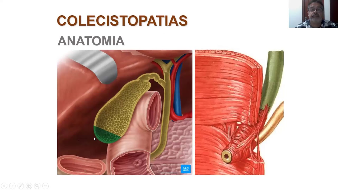 O Que E Colecistopatia Calculosa - BRAINCP