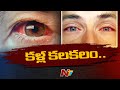  Pink Eye Surge: Weather conditions trigger increase in cases