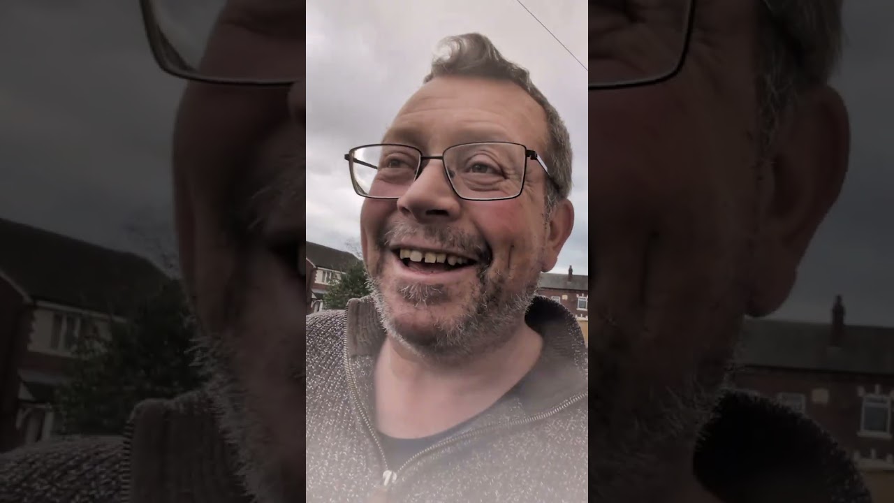 Новая нога, часть 2