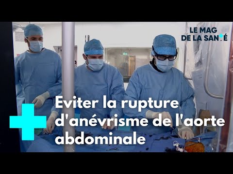 Vidéo: Comment éviter un anévrisme : 14 étapes (avec photos)