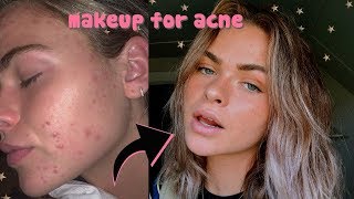 HOW I COVER UP MY ACNE / EVERY DAY MAKEUP ROUTINE FOR FALL