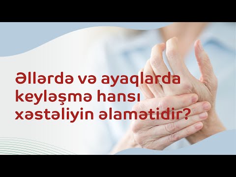 Video: Əllərin dayanıqlılığını artırmaq, sarsılmağı dayandırmaq və çevikliyi artırmaq üçün 10+ sübut olunmuş yol