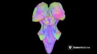 MRI Technology Reveals Deep Brain Pathways | Duke Health