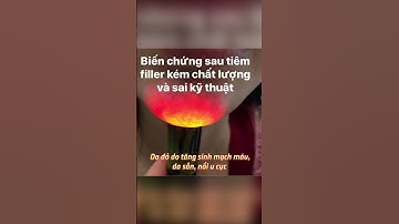 CẢNH BÁO BIẾN CHỨNG KHI TIÊM FILLER KÉM CHẤT LƯỢNG, SAI KỸ THUẬT