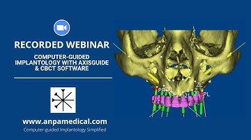 Computer-guided implantology with AxisGuide & CBCT Software.