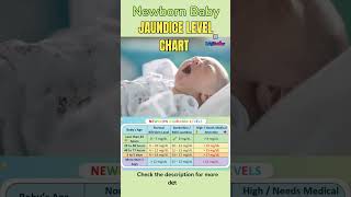 Newborn Bilirubin Levels Safe Or Dangerous Normal Range & Treatment Chart नवजतशश पलय