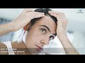 Common myth busters for hair transplant  vplant advanced hair clinic