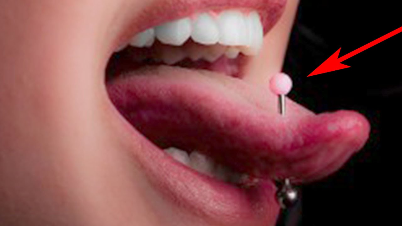 Piercing En La Lengua Infectado Fotos