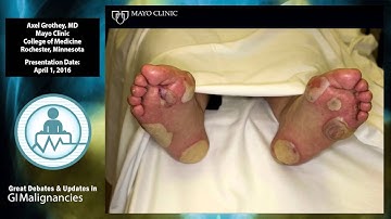 Debate: Salvage therapy for mCRC? - TAS-102 followed by regorafenib