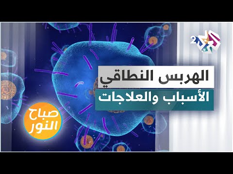 فيديو: لماذا الهربس النطاقي أحادي الجانب؟