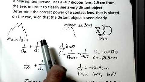 Nearsighted Eye, Lens and Contact Lens to See Distant Object