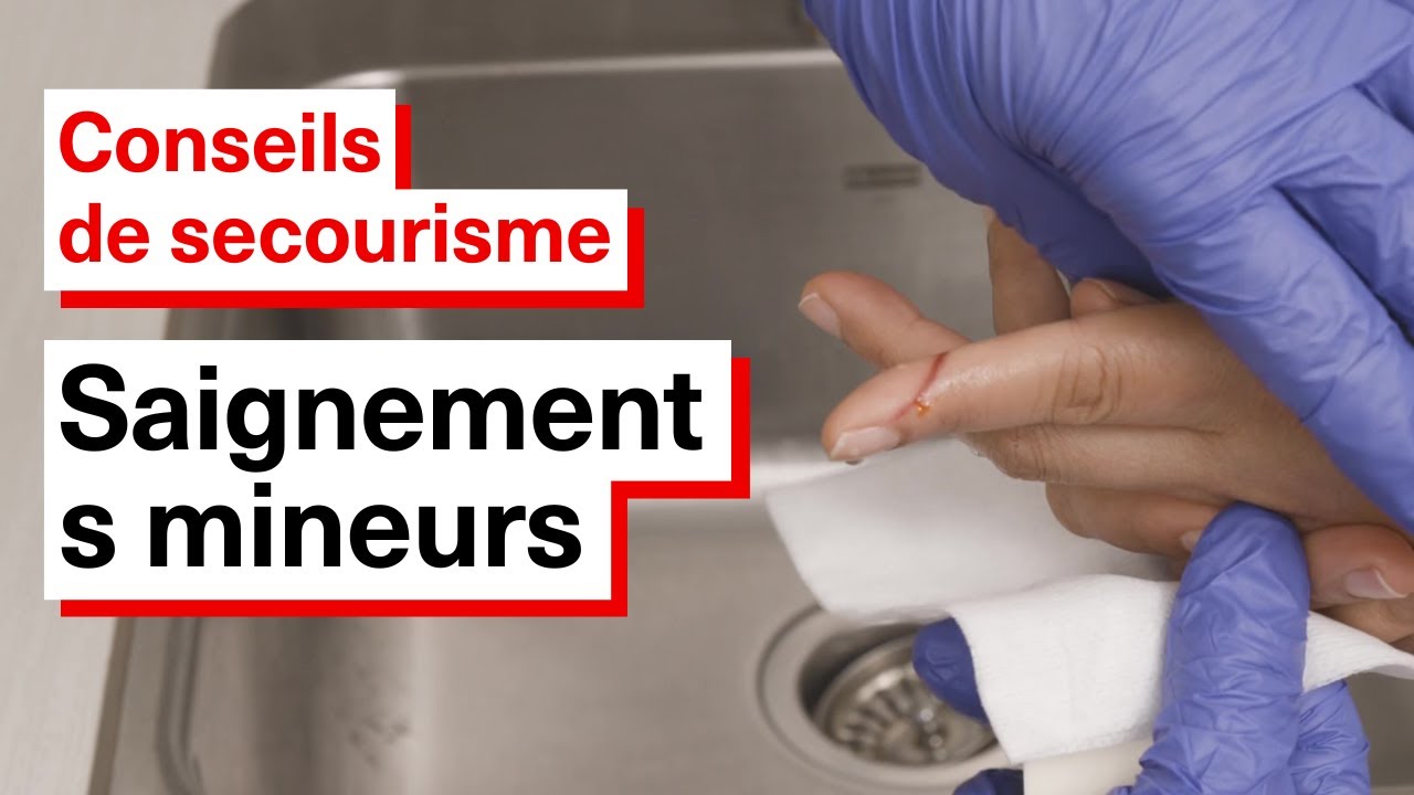 Secourir une personne ayant des saignements mineurs YouTube — free download
