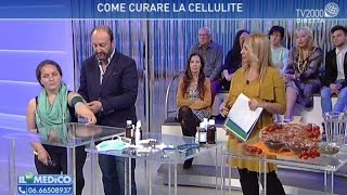 Come curare gambe gonfie, ritenzione idrica e cellulite