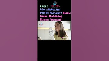 I Got a Robot Arm (And It