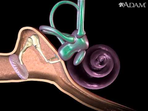 Video: ¿Qué puede dañar la cóclea?