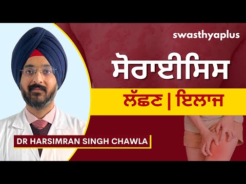 ਸੋਰਾਈਸਿਸ: ਲੱਛਣ ਅਤੇ ਇਲਾਜ | Psoriasis, in Punjabi | Symptoms & Treatment | Dr Harsimran Singh Chawla