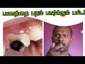 Rs0 toothpaste business link to dental clinic  thavam  tamil