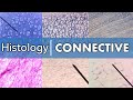 Connective Tissue Quiz