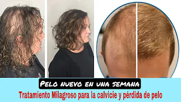 ¿Cómo puedo hacer que me vuelva a crecer el pelo fino?