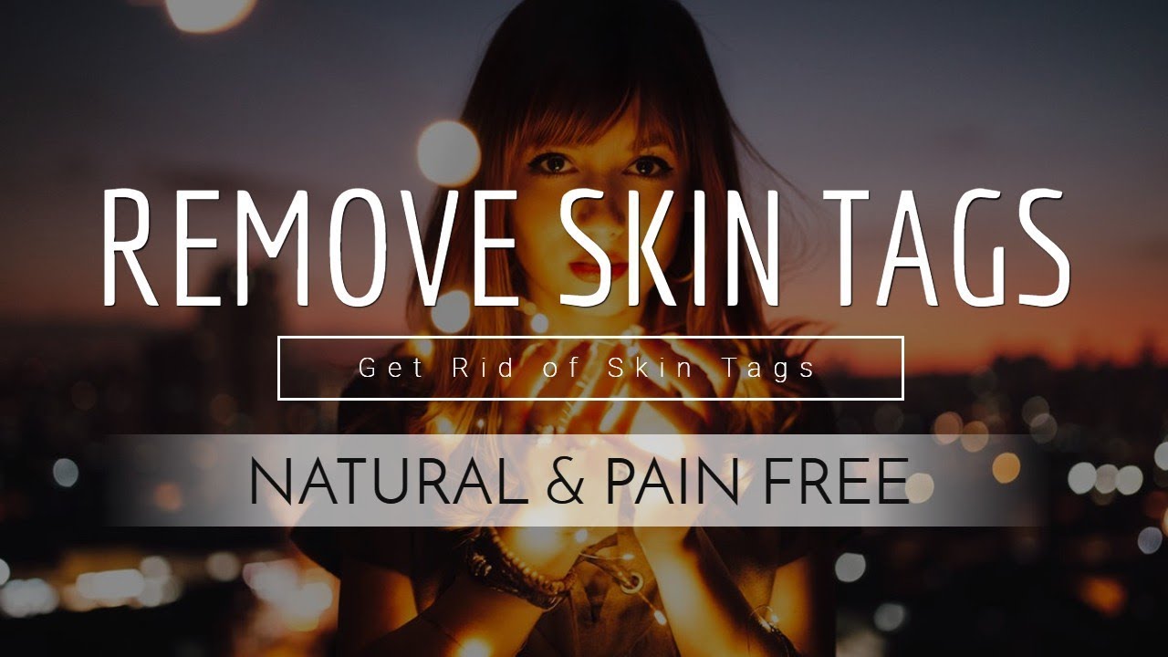 Remove Skin Tag Under Eye At Home | Skin Tag Removal