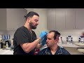 Best Hair Transplant Surgery in Los Angeles, CA. Best FUE Hair Restoration in LA, Beverly Hills, SF