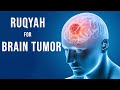 Ruqyah for brain tumor  healing through listening  ruqyah helpline