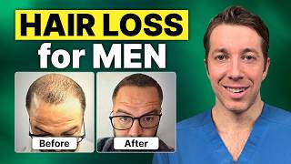 How to Treat Male Hair Loss | Hair Surgeon Advice
