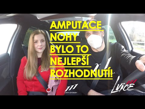 Video: Chlapec S Dvojím Amputací Potkal Psa Se čtyřmi Amputacemi (a Slzy Pronásledují)