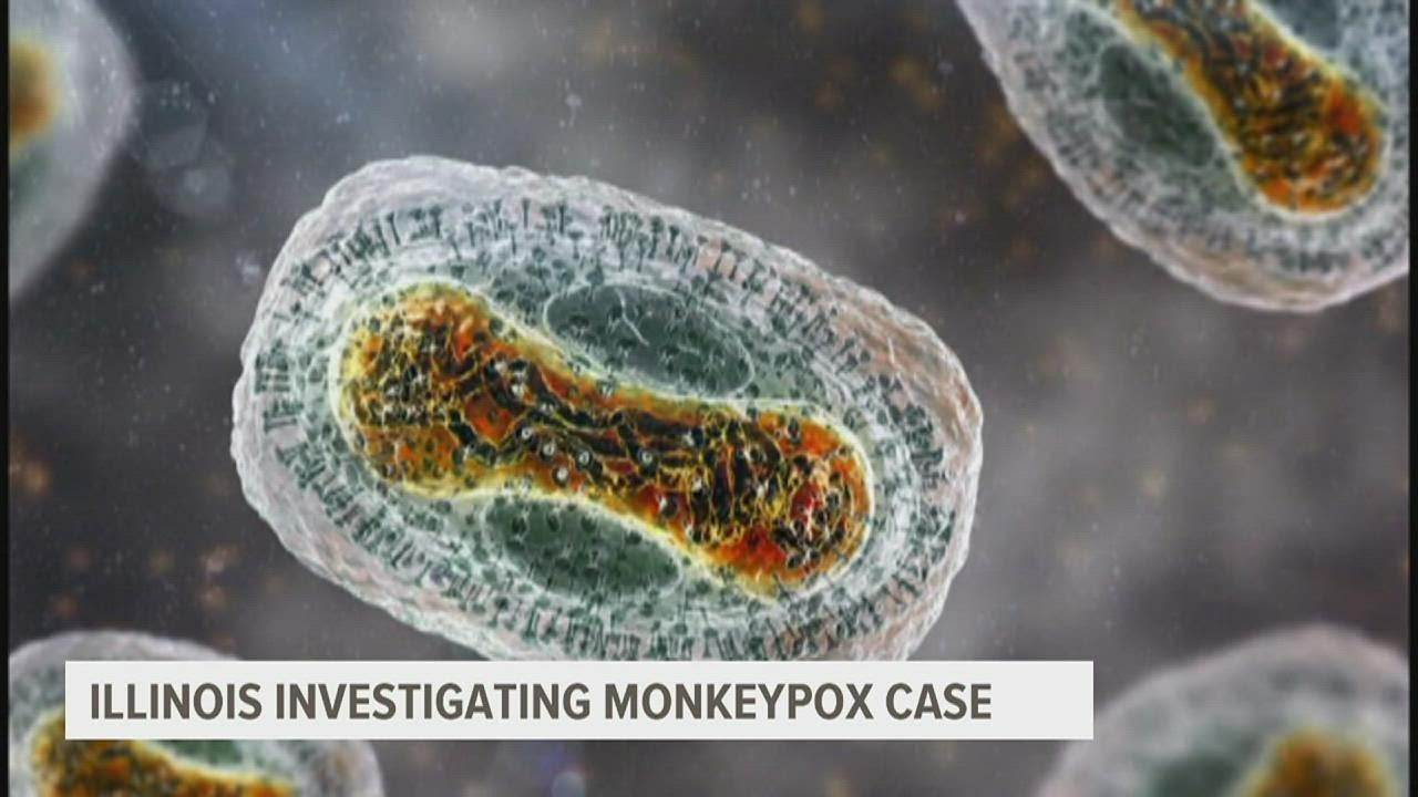 Illinois investigating adult case of monkeypox close to Champaign-area daycare