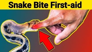 Snake Bite First aid || What Happens To Your Body When a Snake Bites You? || Health Flavour